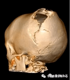 脑的骨相学图片(苏民峰的相学图片)-星座123